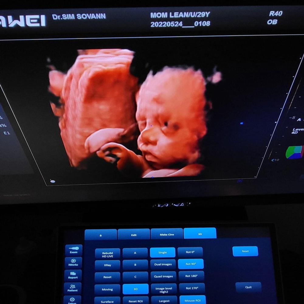 5D Ultrasound Color Doppler DW-T50