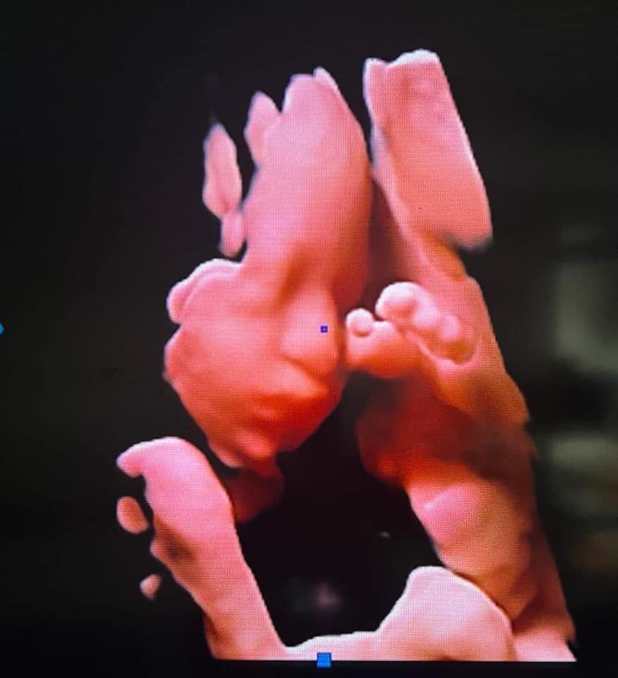 5D Ultrasound Color Doppler DW-T50