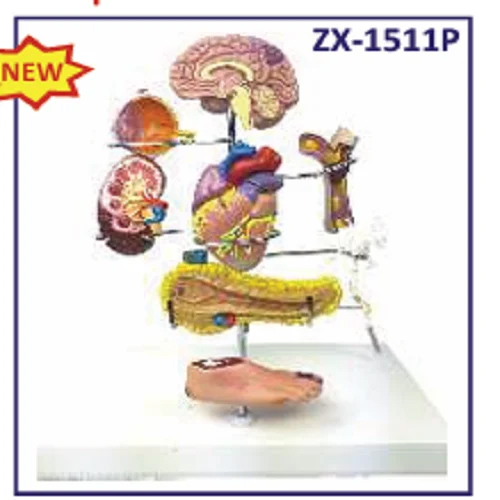 Pulmonary Arterial Hypertension Model
