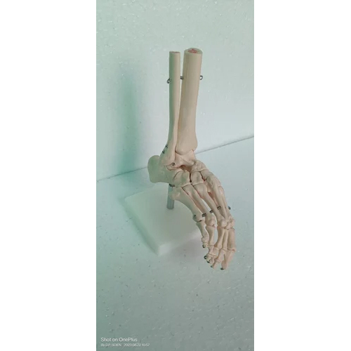 Pulmonary Arterial Hypertension Model