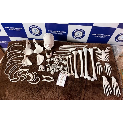 Articulated Club Foot Model