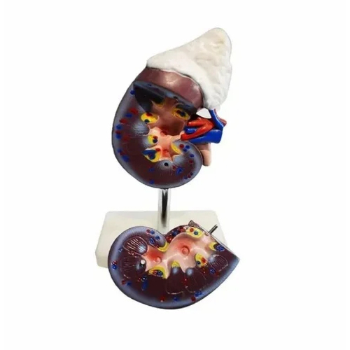 Pvc Human Kidney Model - Application: Medical