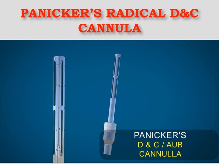 Panickers Radical D&C Cannula For Gynecologist For Uterine Evacuation And Curettage