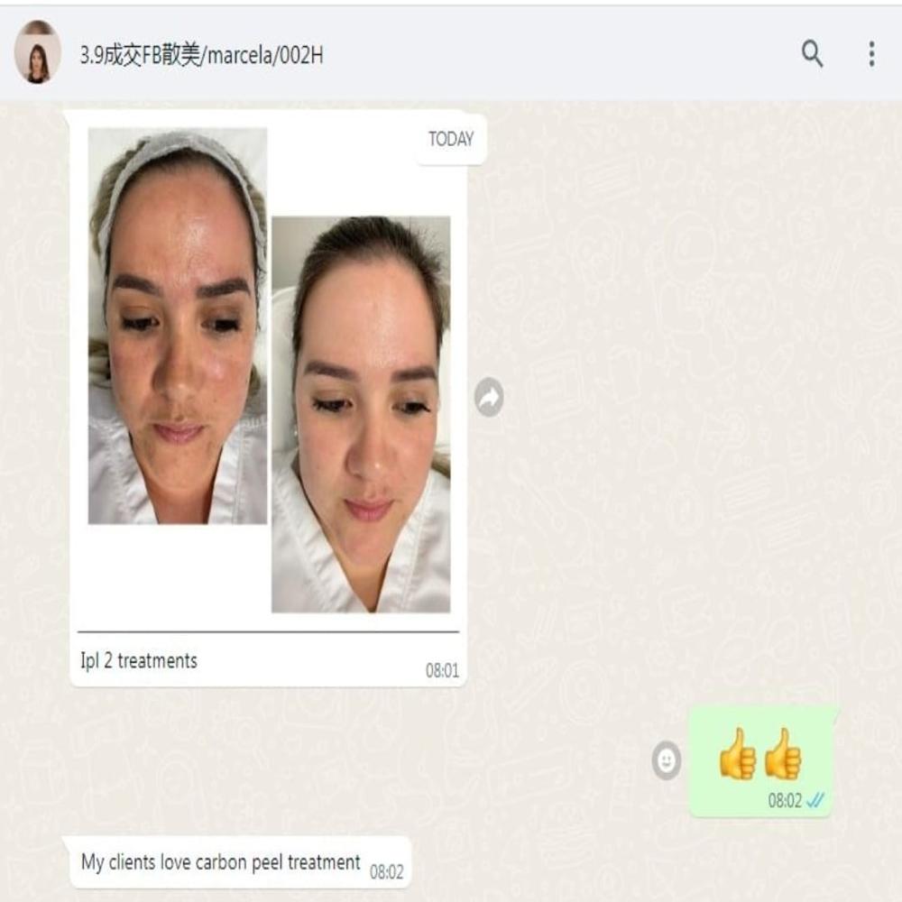 Global Laser IPL Machine