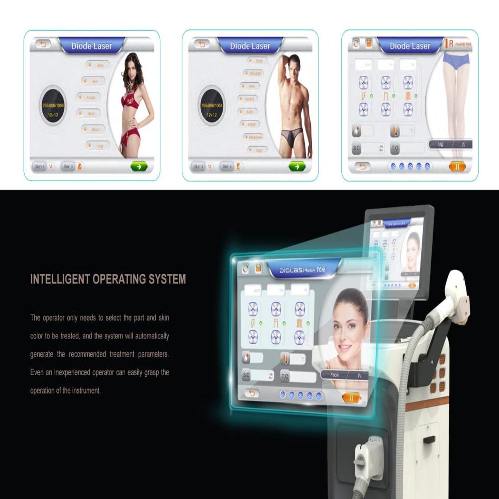 Alpinion Ultrasound Color Doppler Machine - Color Code: Gray