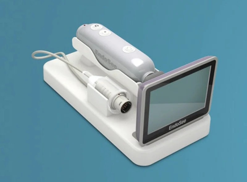 Endosee Handheld Hysteroscopy LiNA OperAScope Moving Hysteroscopy from OR to the Office