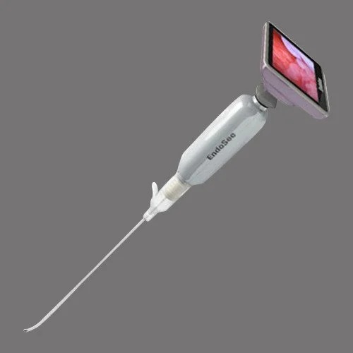 Endosee Handheld Hysteroscopy LiNA OperAScope Moving Hysteroscopy from OR to the Office