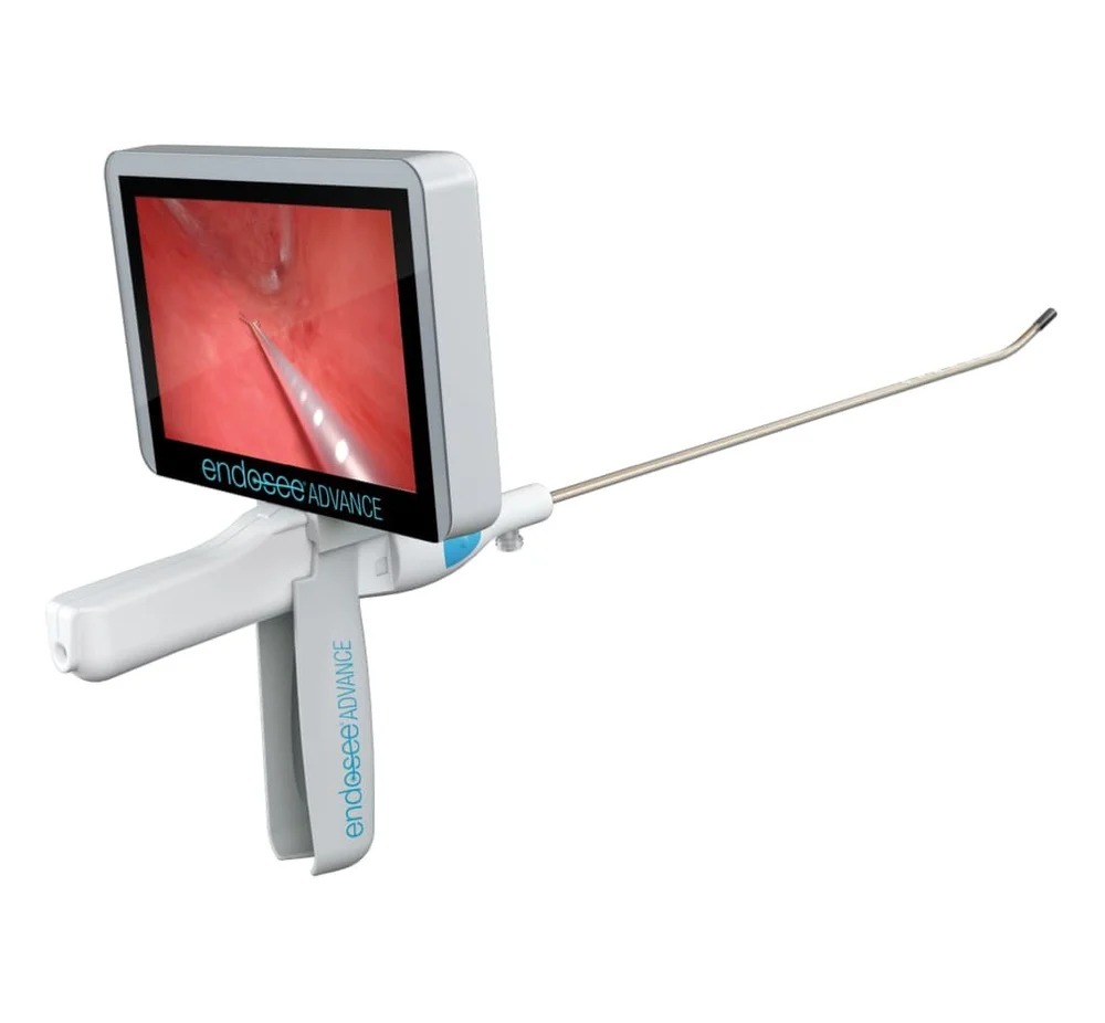 Endosee Handheld Hysteroscopy LiNA OperAScope Moving Hysteroscopy from OR to the Office