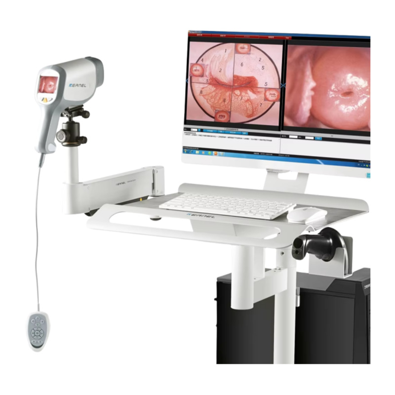 Kn-2200I Colposcopy High Quality Video Colposcope For Gynecology - Material: Plastic