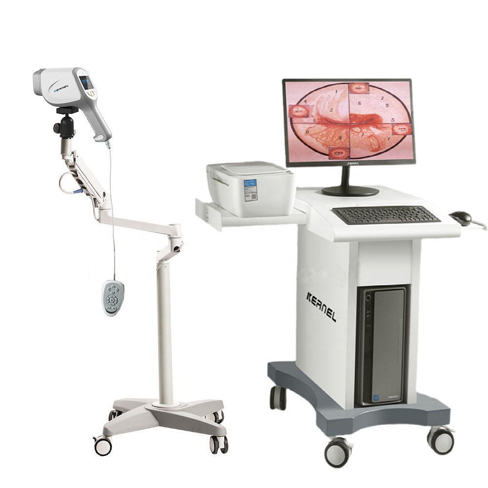 Kn-2200A Medical Colposcope Device Colposcopio Digital Colposcope - Feature: High Quality