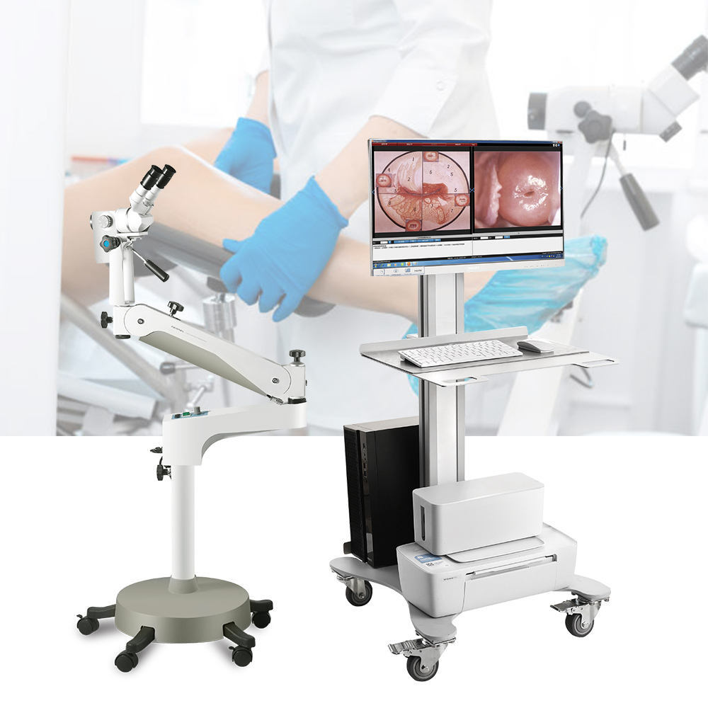 Medical Examination Mobile Binocular Gynecology Colposcope - Feature: High Quality