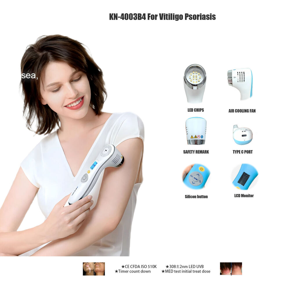 Professional 308Nm Excimer Led Uvb Phototherapy Device Lamp - Attributes: High Quality