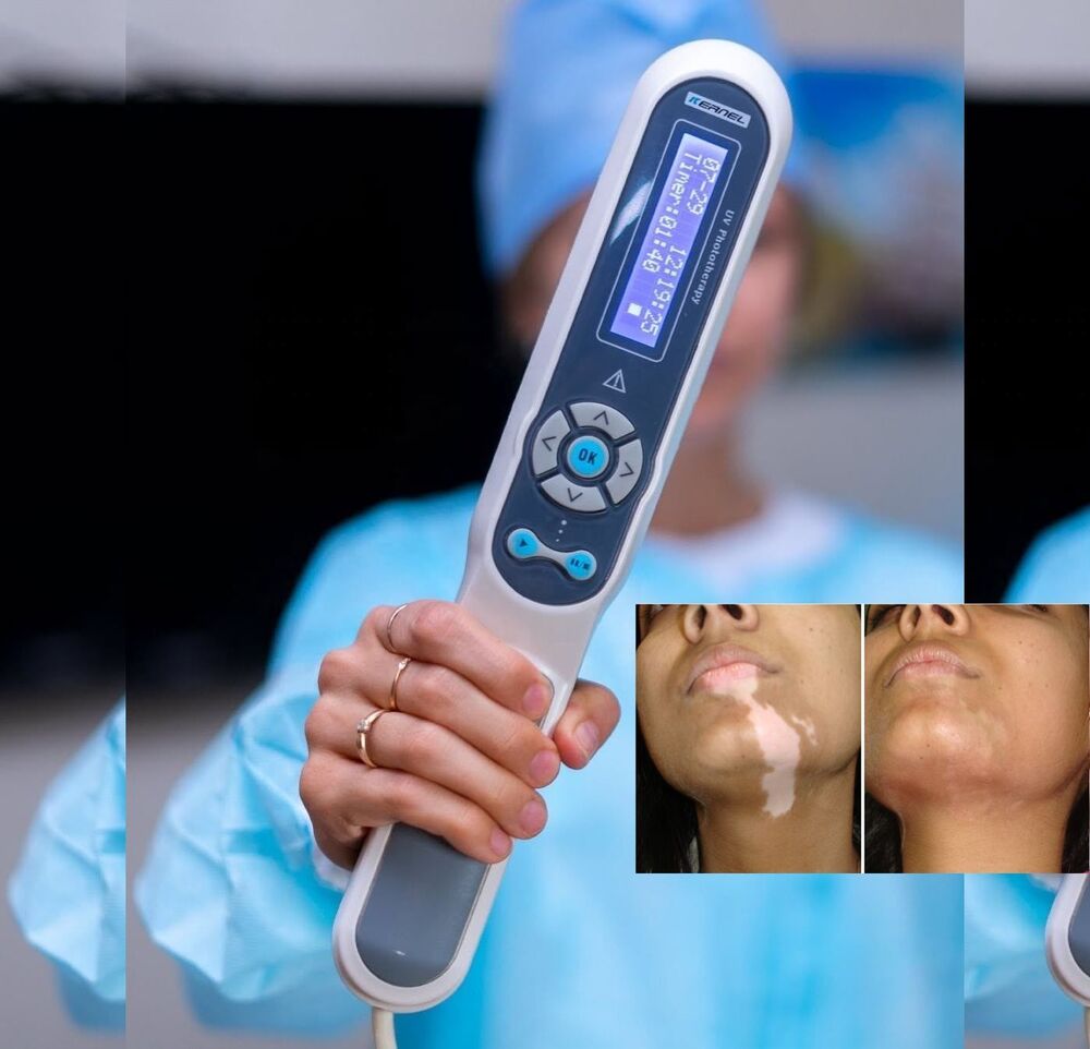 Kn-4003Bl Uv Phototherapy 311Nm Uvb Lamp - Feature: High Quality