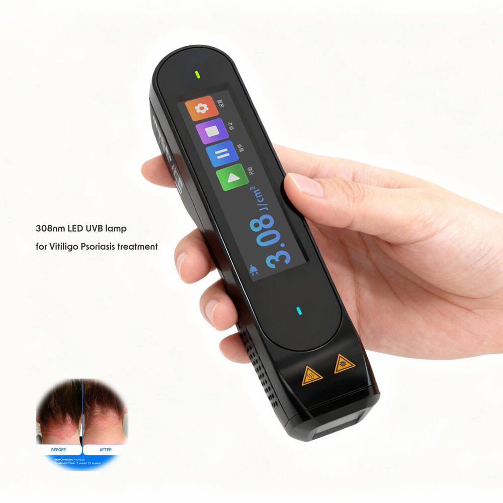 Medical Grade 308Nm Excimer Laser Device - Feature: High Quality