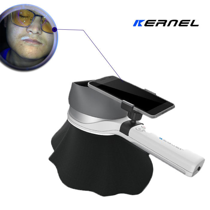 Portable Skin Analysis Dermatology Dermoscopy Wood'S Lamp - Attributes: High Quality
