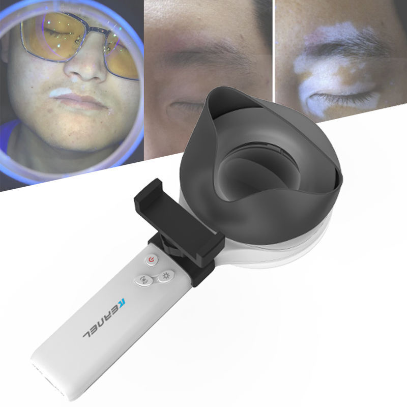 Kn-9000B Led Portable Medical 365Nm Woods Lamp For Skin Analysis - Accuracy: 100 %