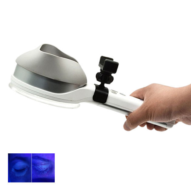 Medical Ce Facial Skin Analyzer Wood Lamp - Attributes: High Quality