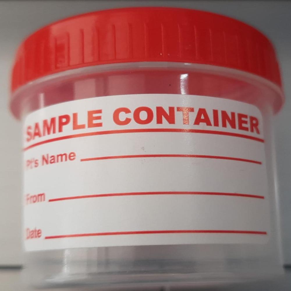 Urine Container 30ml Sterile