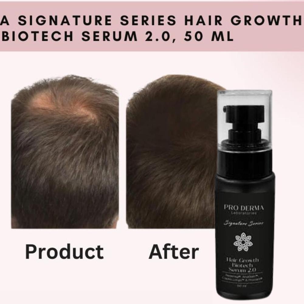 Pro Derma Hair Growth Serum Hair Fall Treatment