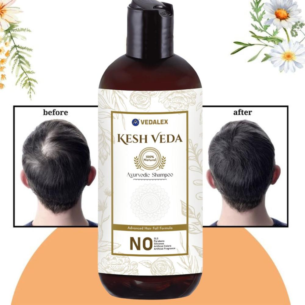 Kesh Veda Ayurvedic Shampoo 500ml | Herbal Hair Growth Shampoo for Fuller, Longer & Stronger Hair