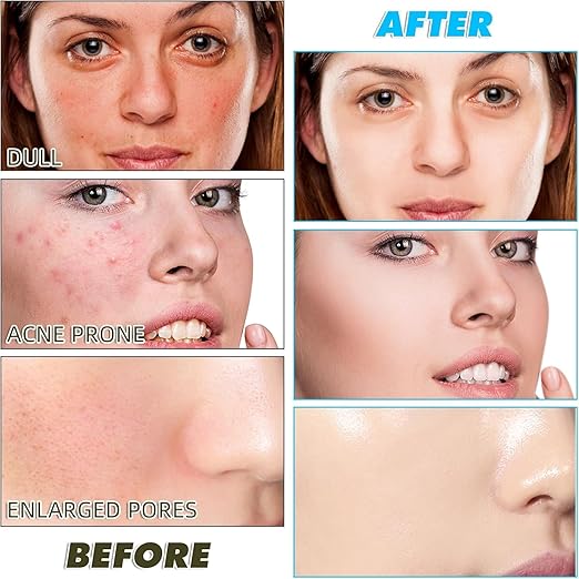 Turmeric Kojic Aeid Lemon Chamomile Peds