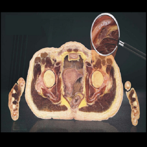 HD Virtual Dissection Table 88