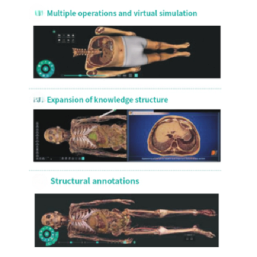 HD Virtual Dissection Table 88