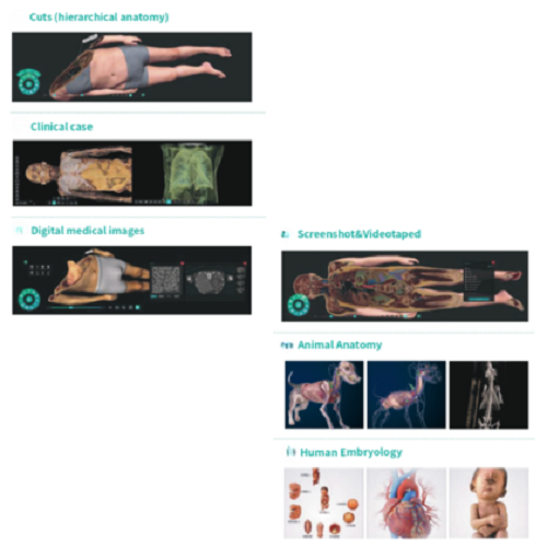 HD Virtual Dissection Table 88