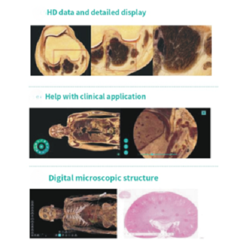 HD Virtual Dissection Table 88