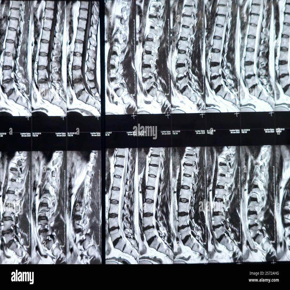 Airis Mate 0.2 Tesla