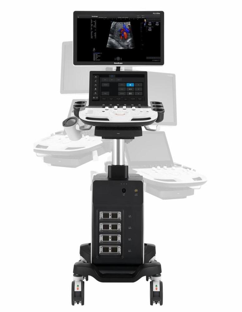 Sonoscape P11 Elite X-ray Machine