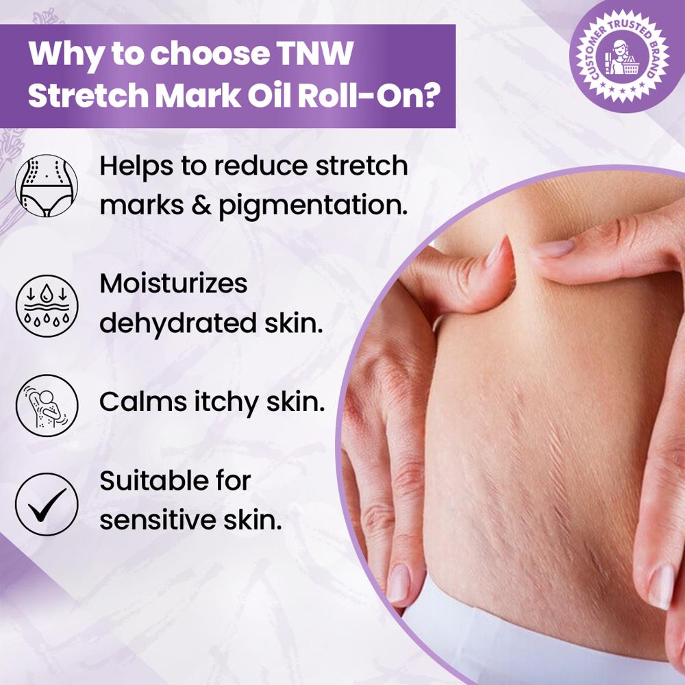 TNW - The Natural Wash Stretch Mark Oil with Roll On for Reducing Scars & Pigmentation