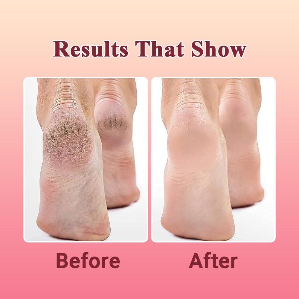 Alglaze Hand & Foot Cream | Shea Butter, Turmeric Oil & Aloe Vera | 50g