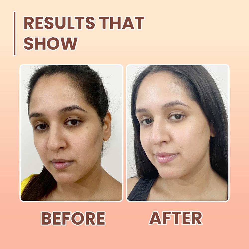 Alglaze Antioxidant E Face Serum with Niacinamide & Hyaluronic Acid