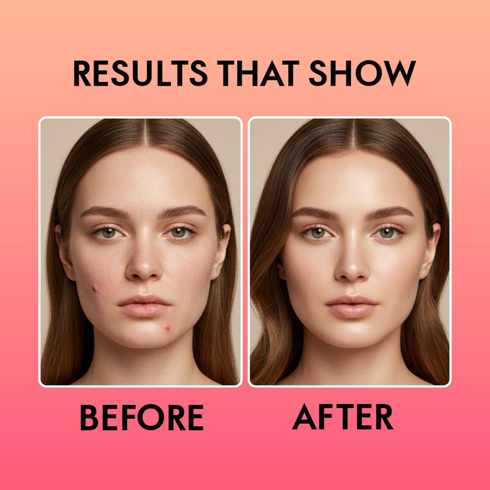 Alglaze Watermelon Face Gel with Niacinamide & Hyaluronic Acid