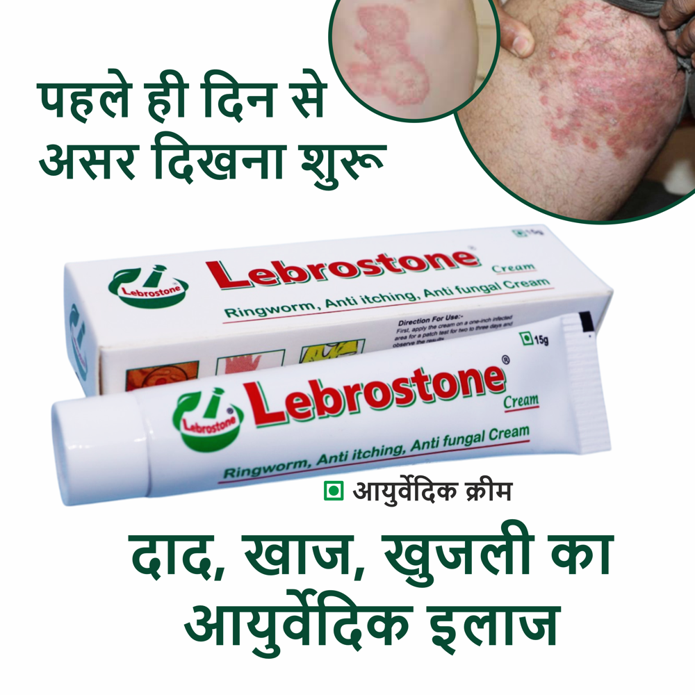  Lebrostone Ayurvedic Skin Care Cream 15g Treatment for Ringworm, Anti Itching, & Anti Fungal Infections