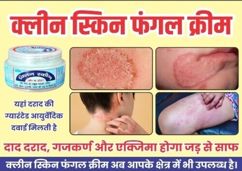 Clean Skin Antifungal Cream (50 G) - Age Group: Suitable For All Ages