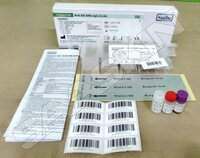 MAGLUMI Anti-SS-A/Ro IgG (CLIA)