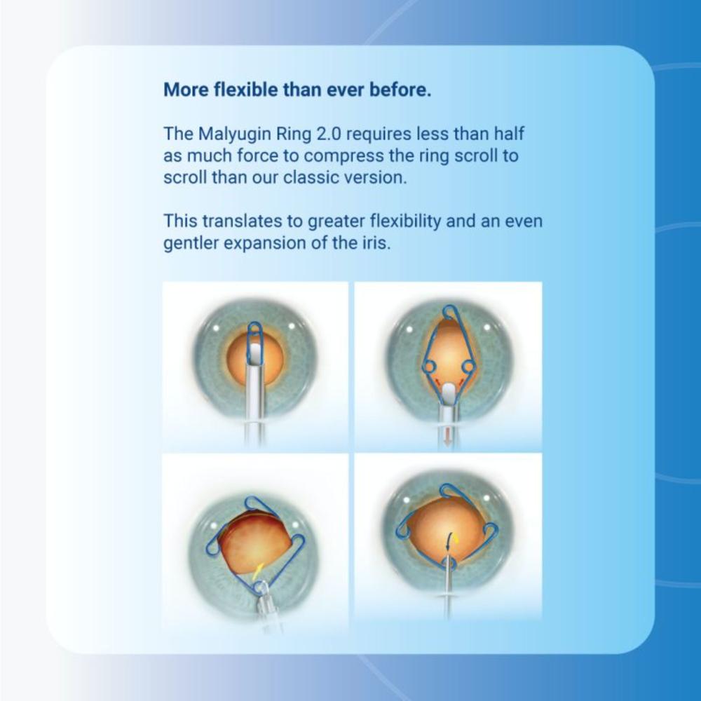 Malyugin Ring Pupil Expander Preloaded MST USA - 6.25mm & 7.00 mm