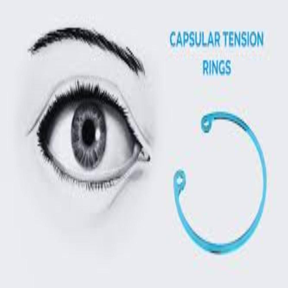 Capsular Tension Ring & Cionee Ring - Frame Color: Silver
