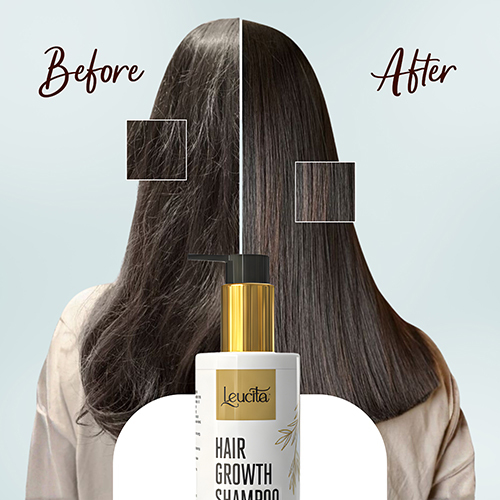 Hair Growth Shampoo
