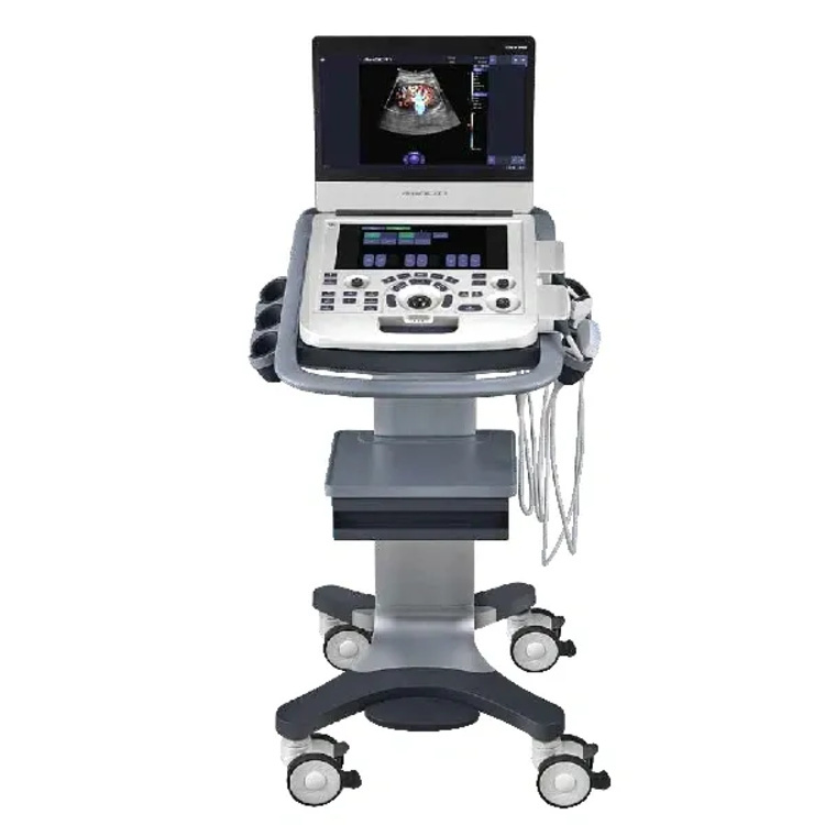 Ultrasound Machine