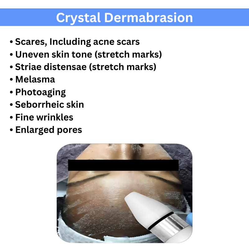 Microdermabrasion 6in1 Machine - Color: White