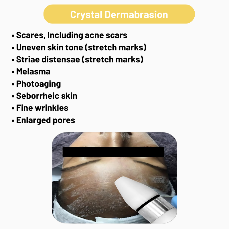 4 In 1 Hydra Facial Mda Machine