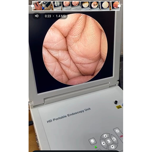 Endoscopy Machine