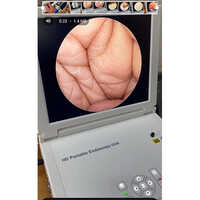 Endoscopy Machine