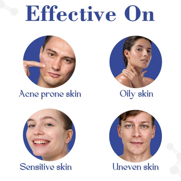 Acnetop Acne Top S Face Wash - Color Code: N/A at 79.30 INR at Best Price in ...