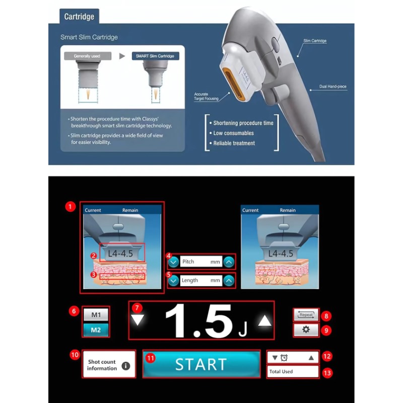 Portable Hifu Machine - Color: White