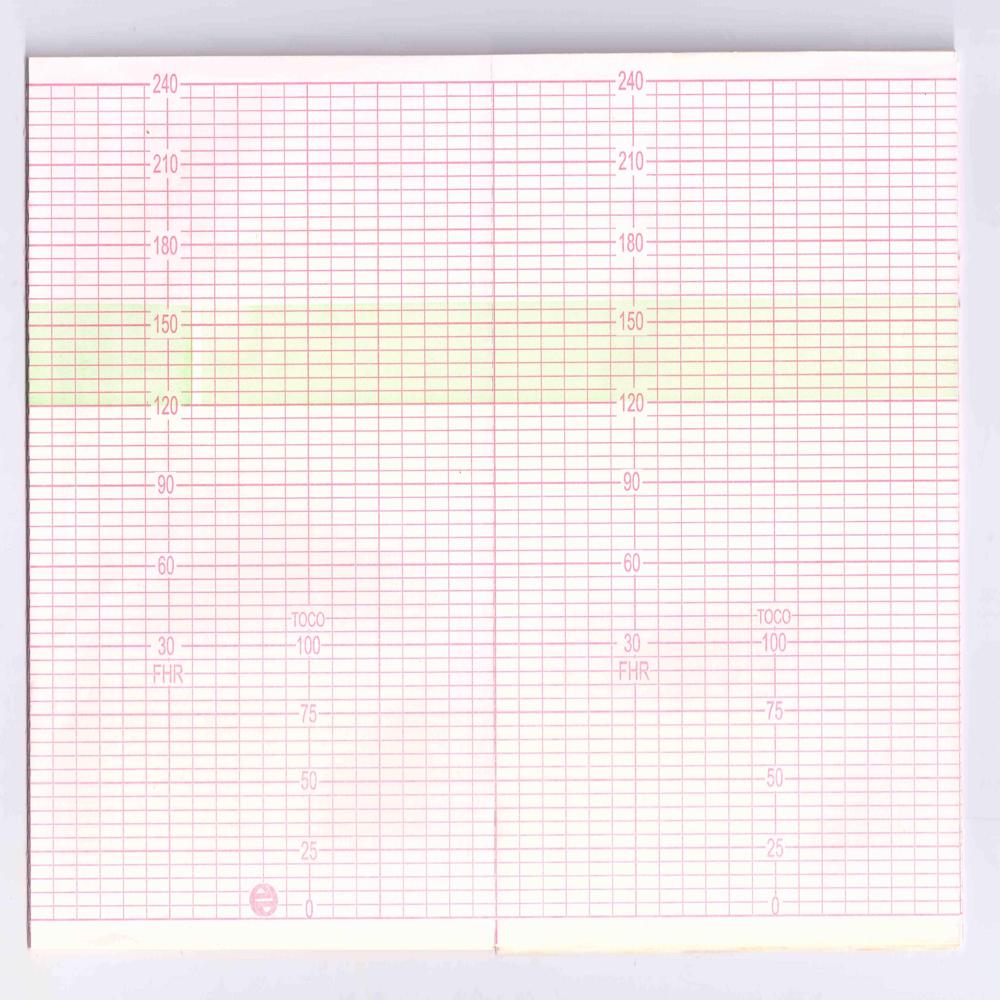 Fetal Chart Paper - Size: All Sizes