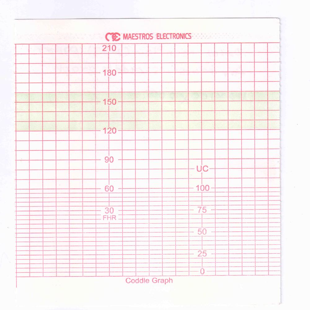 Fetal Chart Paper - Size: All Sizes